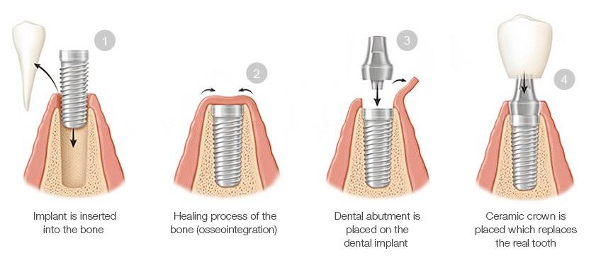 Tooth Logo